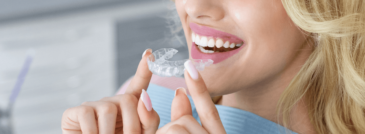 clear aligners