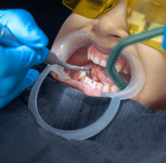 treatment process