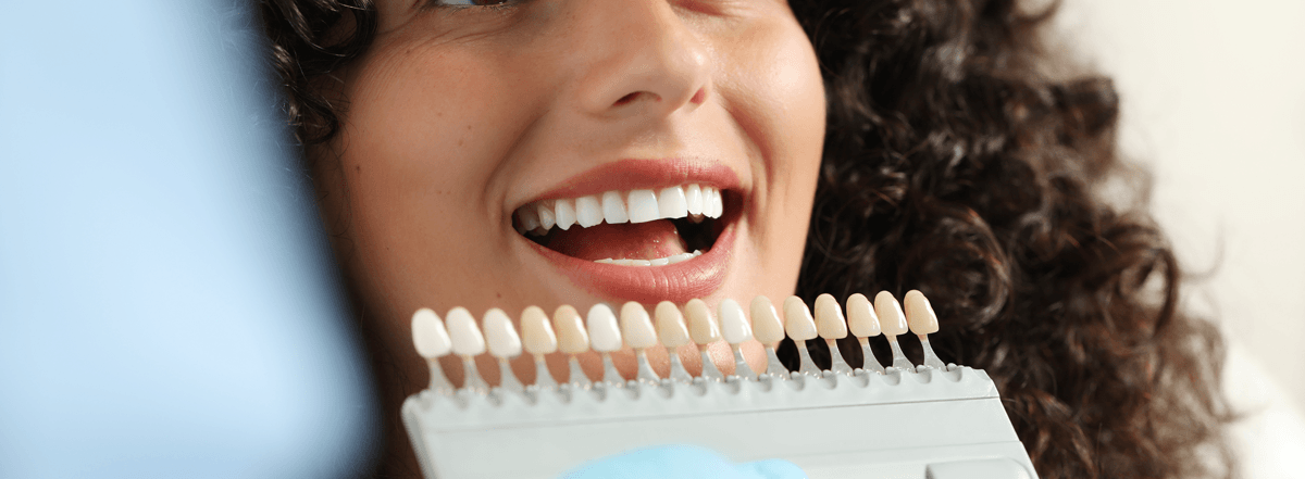 veneers-banner